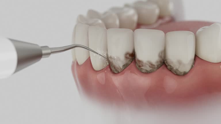 Trusted Teeth Whitening service in McPherson, KS - Dentist Open Now